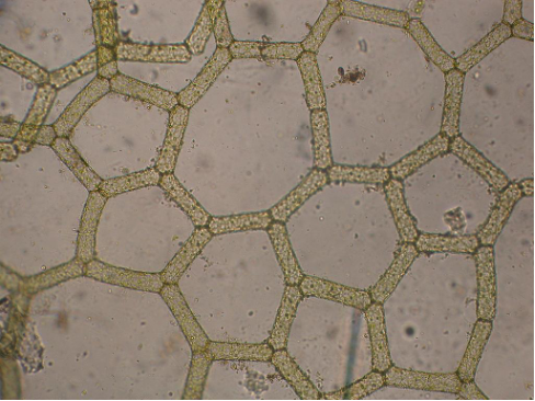 A microscopic photo of green algae cells