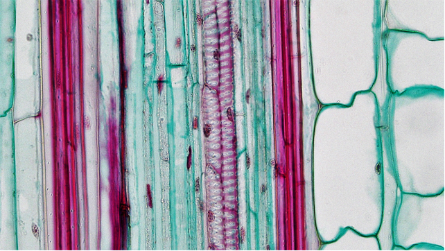 Microscopic photo of longitudinal cross section showing vessels