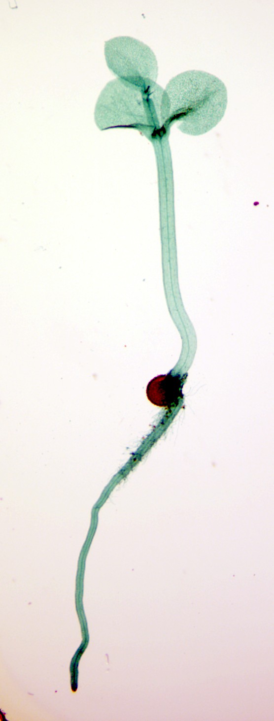 A microscopic image of a green root and sporophyte that emerges from a brown megaspore