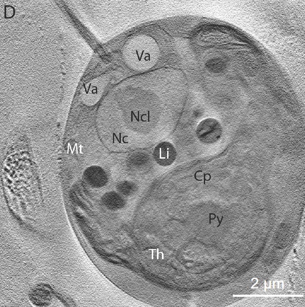 X-ray microtomography of Chlamydomonas reinhardtii