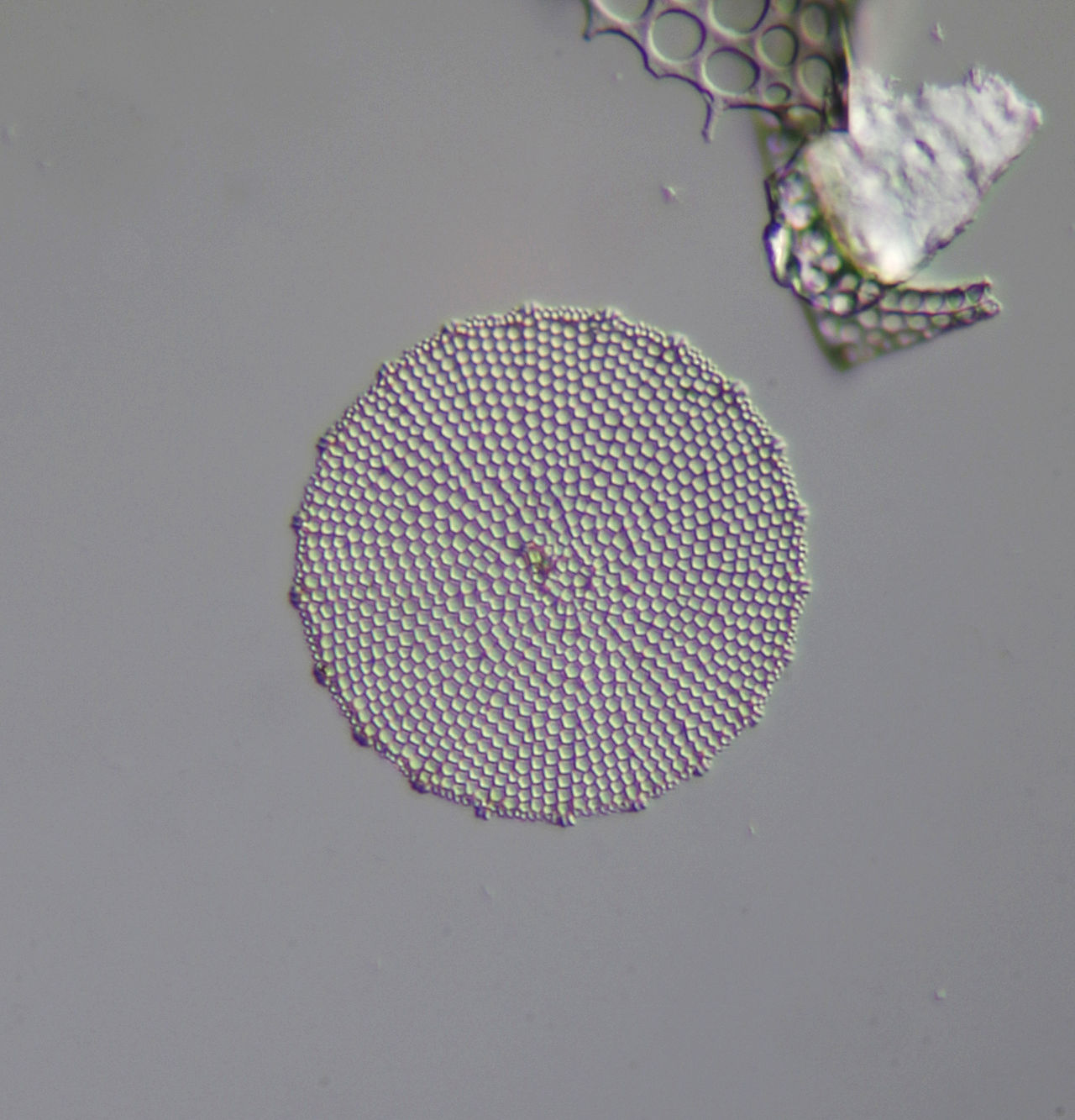 diatom under a microscope