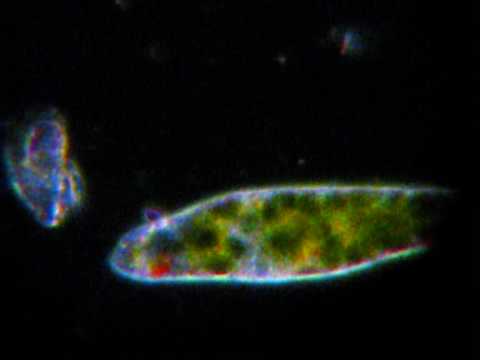 Thumbnail for the embedded element "Euglena in Darkfield at 100X, 200X and 400X"