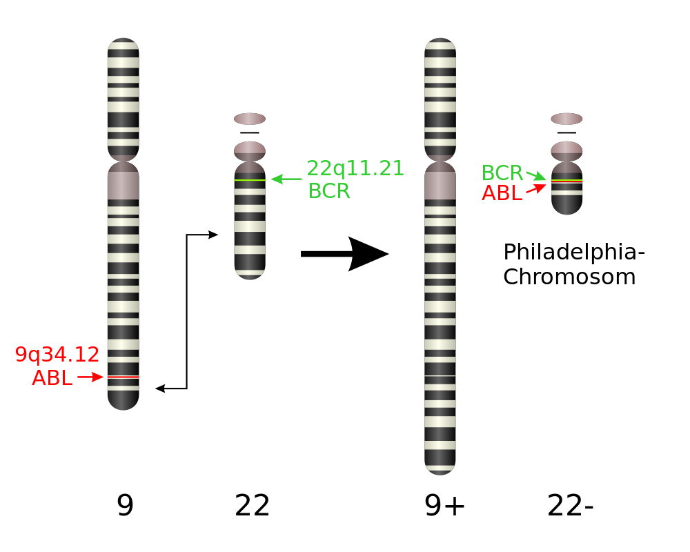 Una ilustración de la Translocación Cromosómica Filadelfia.