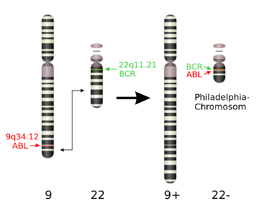An illustration of Philadelphia Chromosome Translocation.