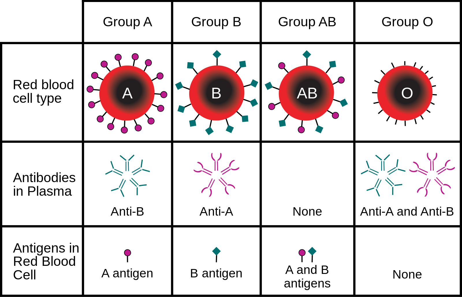 Diagram of ABO blood groups and the IgM antibodies present in each.