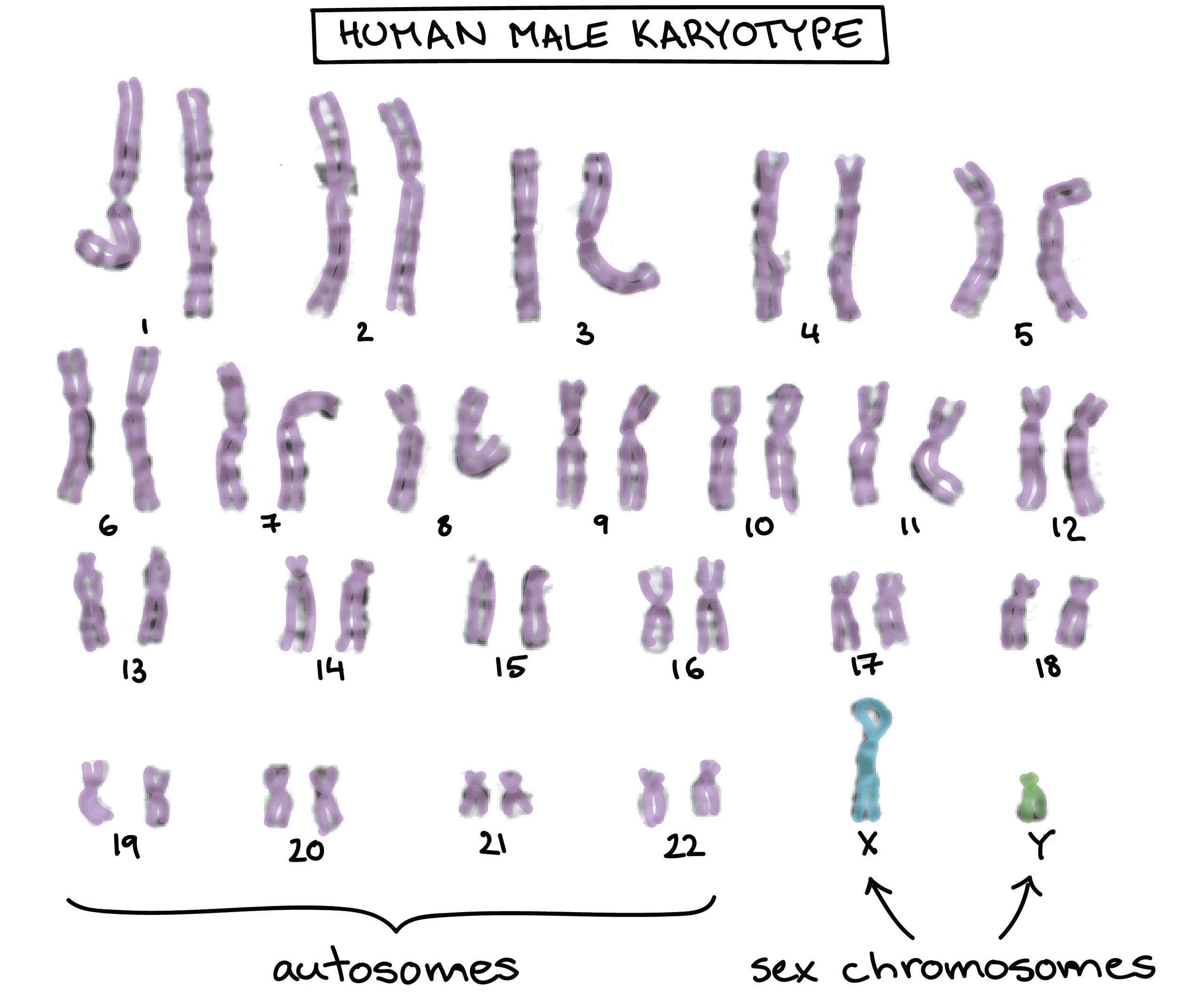 Imagen de un cariotipo humano, mostrando los 44 autosomas en pares coincidentes y 2 cromosomas sexuales disímiles (X e Y)