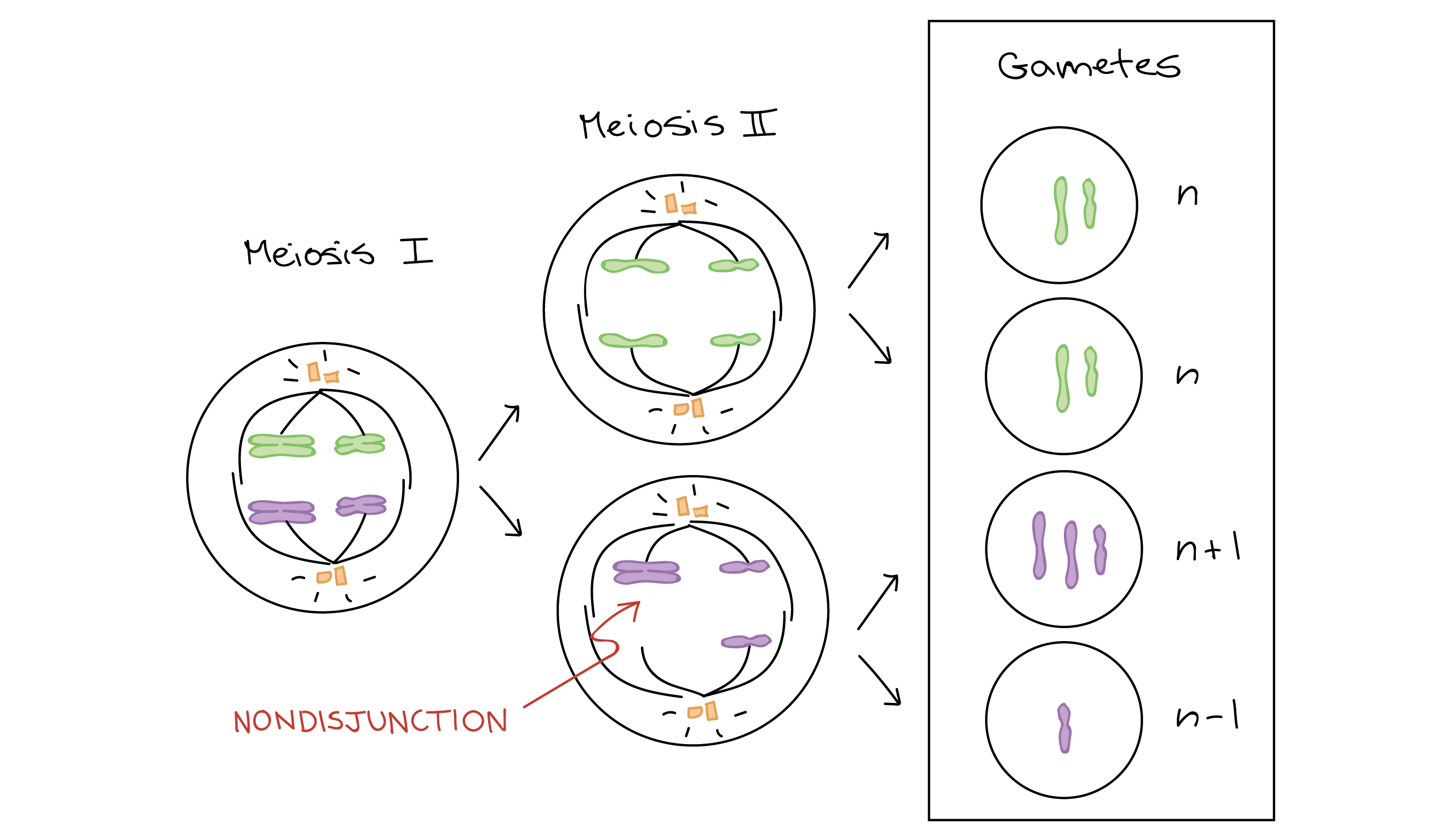 Diagram depicting nondisjunction in meioisis II. Homologous chromosomes separate normally during meiosis I. However, the sister chromatids of one chromosome fail to separate during meiosis II, and instead move to the same pole of the cell and are segregated into the same gamete. In this case, the products of meiosis are two normal, euploid gametes (n), one gamete with an extra chromosome (n+1), and one gamete with a missing chromosome (n-1).
