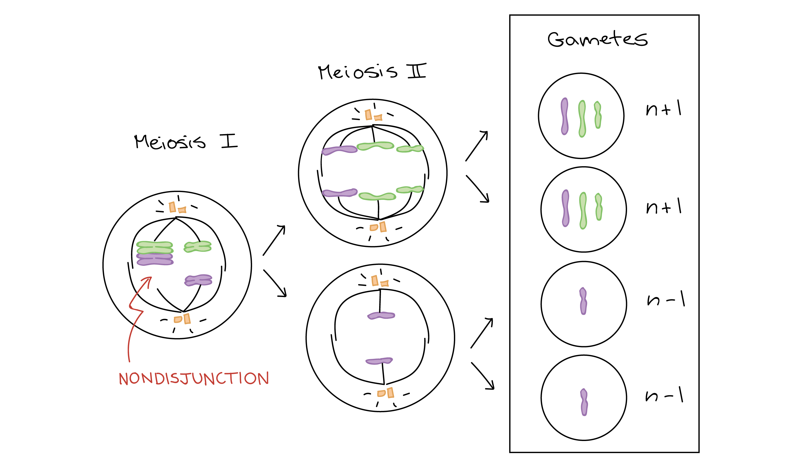 Diagram depicting nondisjunction in meioisis I. One pair of homologous chromosomes fail to separate during meiosis I, leading to two abnormal cells as products of meiosis I: one cell with an extra chromosome and one with a missing chromosome. In meiosis II, the chromatid of the chromosomes are separated normally. This leads to production of two gametes with an extra chromosome (n+1 gametes) and two gametes with a missing chromosome (n-1 gametes).