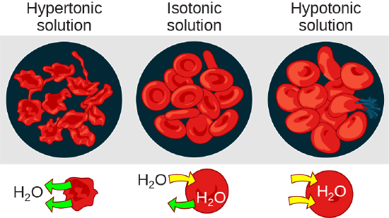 Red blood cells and subsequent water movement in hypertonic, isotonic, and hypotonic environments