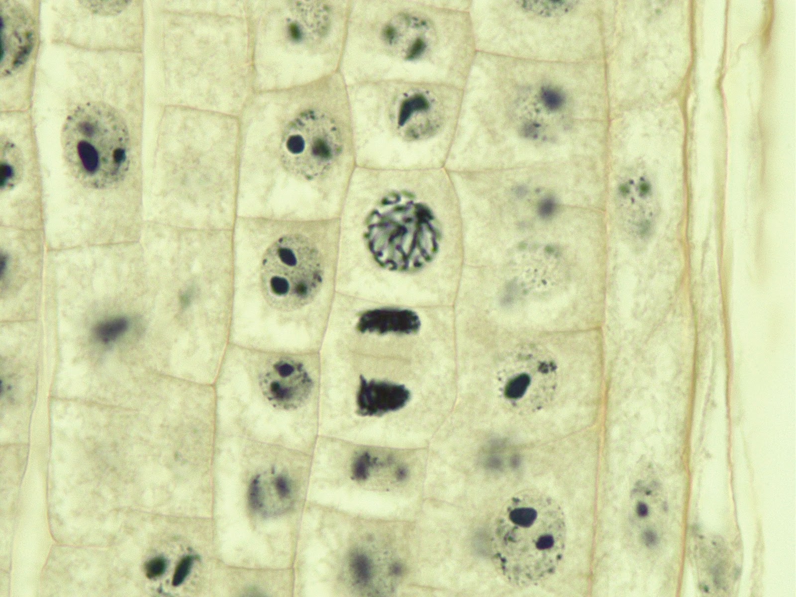 Cytokinesis in onion root tip plant cells shown under the microscope