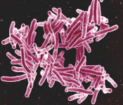 BIOL 440: General Microbiology (Hughes)