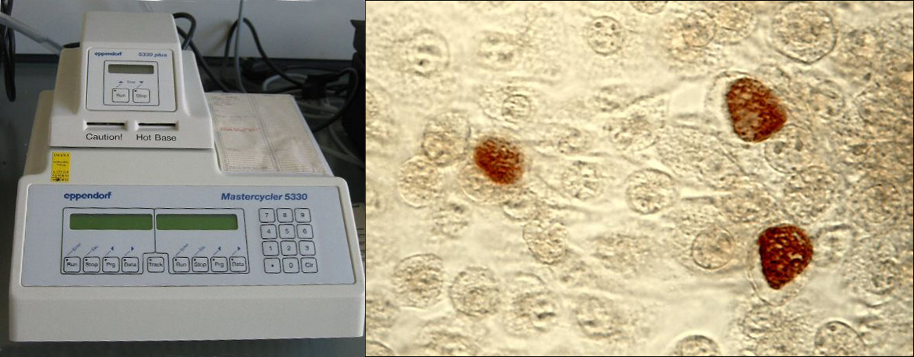 A photograph of a thermocycler; a desktop machine with a heating element and temperature display. A micrograph of oval cells; most are clear but a few are orange.