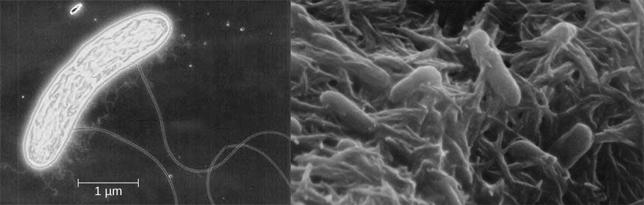 Micrografía de una celda en forma de varilla con proyecciones largas. La celda tiene aproximadamente 5 µm de largo. Otra micrografía que muestra muchas células en forma de varilla unidas a una matriz.