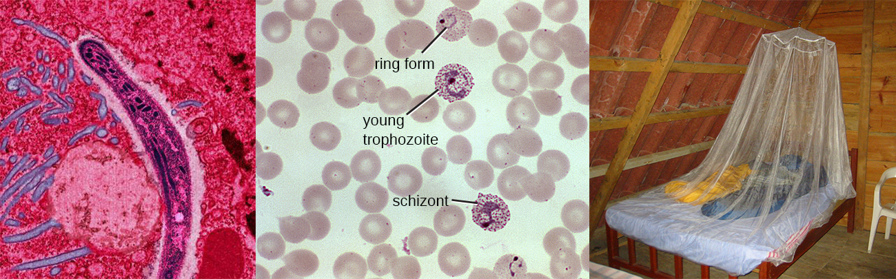Micrograph of a long cell. Micrograph of blood cells. Some have a red ring labeled “ring form”, others have dark dots and a larger ring labeled “young trophozoite”, and others have many dark dots and an amorphous structure labeled “schizont”. A photograph of mosquito netting over a bed.