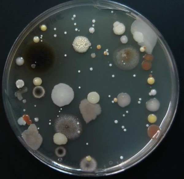 zig zag environmental sample with diverse types of colonies