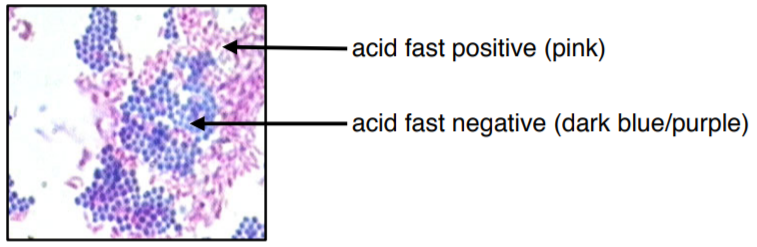 14: Acid-Fast Stain