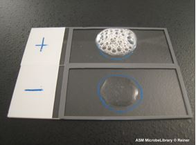 catalase positive bacteria produces bubbles during catalase test; catalase negative bacteria produces no bubbles during catalase test
