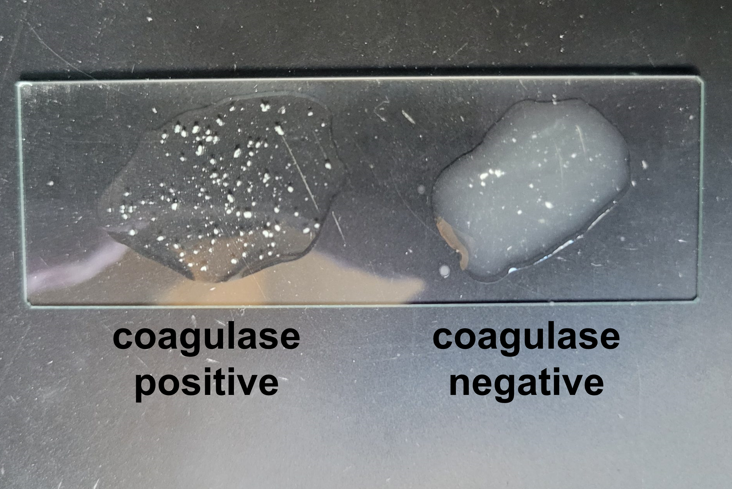 coagulase slide test showing coagulase positive and coagulase negative results