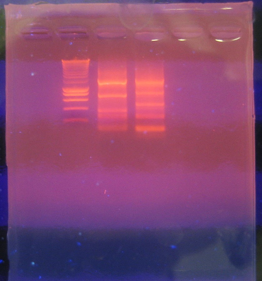 32: DNA Fingerprinting