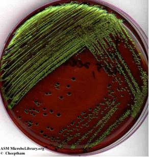 EMB plate with E. coli shows E. coli growing on the petri plate produces a metallic green color