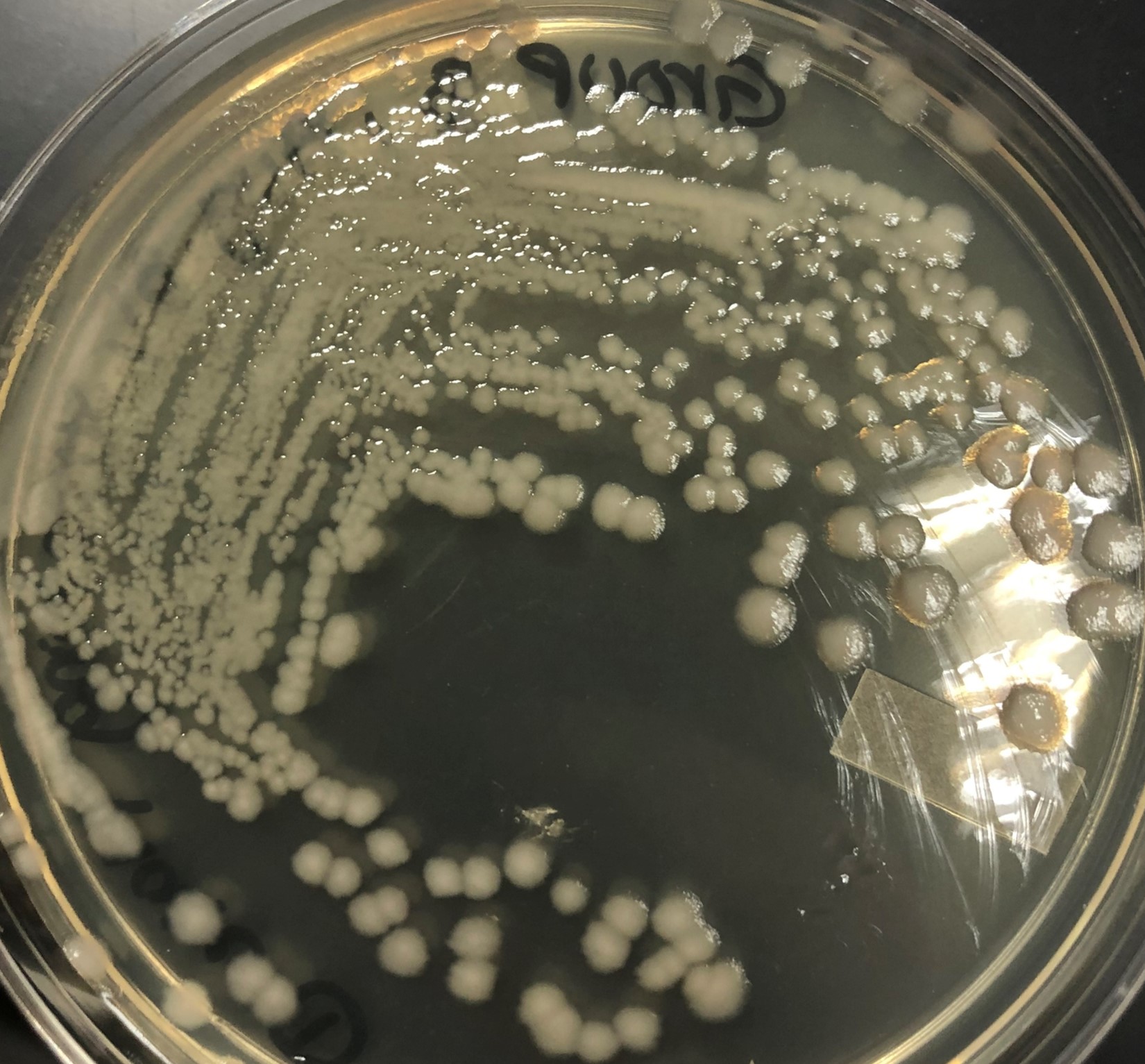 41: Unknown Bacteria Identification Project