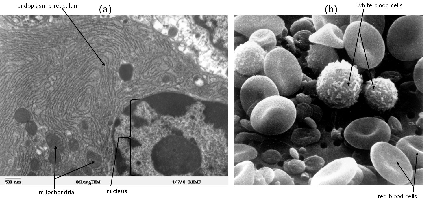 electron microscope images showing different appearances of TEM images and SEM images