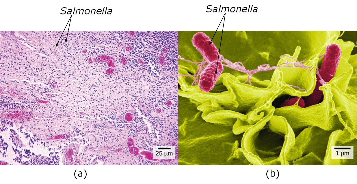 bacteria in a light microscope image versus bacteria in an electron microscope image