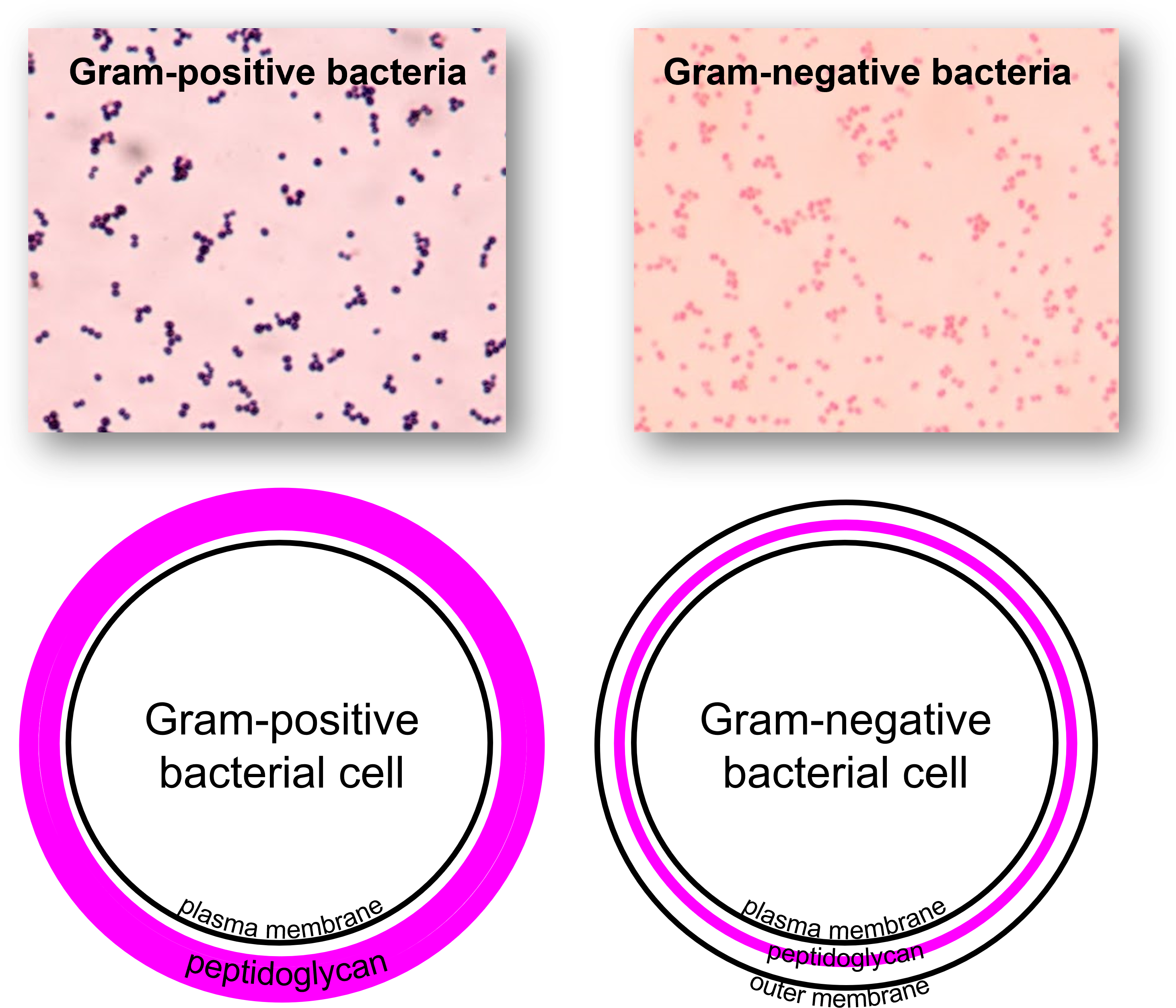 Gram stain cell walls diagram