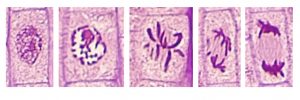 Micrograph of stages of mitosis in onion root tip