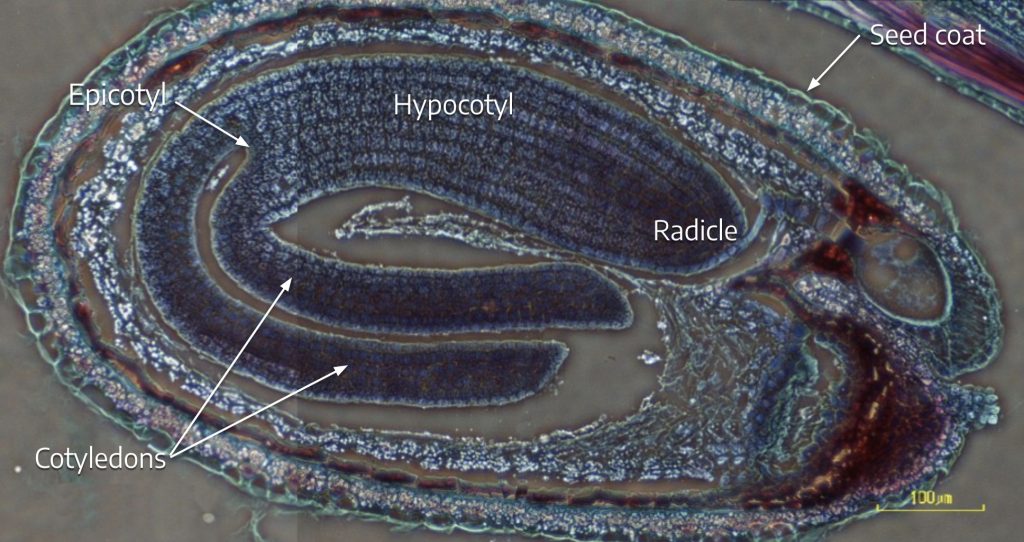 Micrograph of late stage embryo