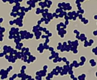 staphylococcus image