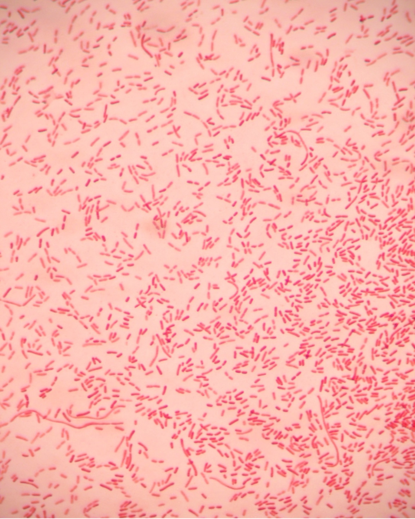 Gram stain exercise 9.4 - pink rods