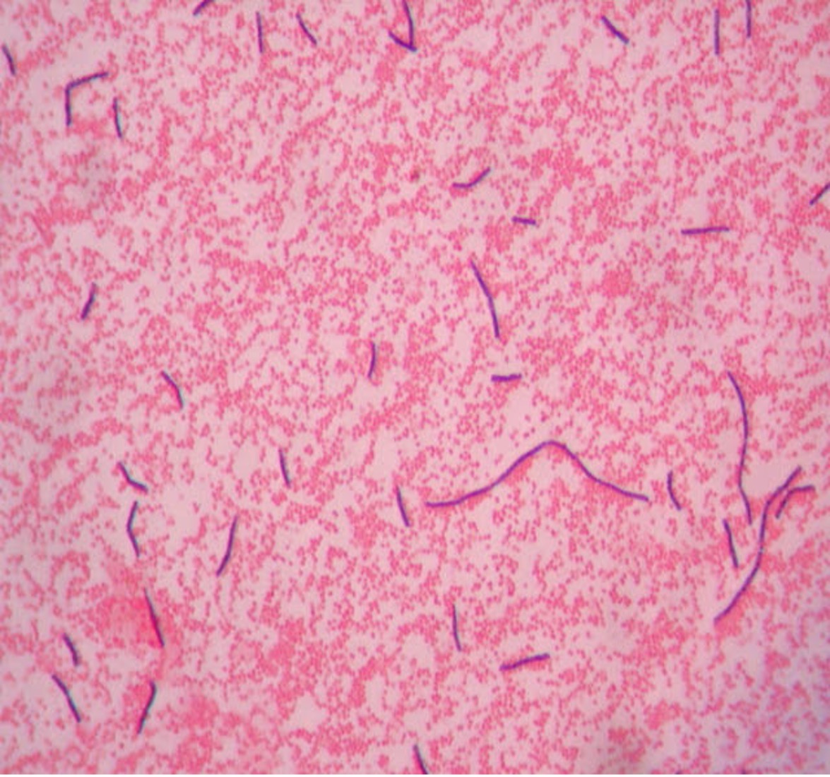pink round cells mixed with purple rods