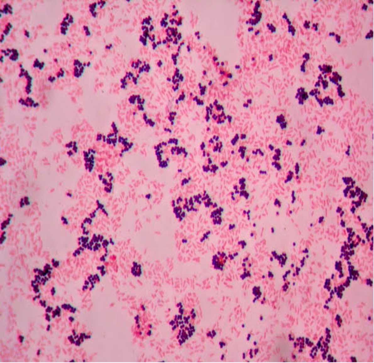 purple round cells mixed with pink rod cells