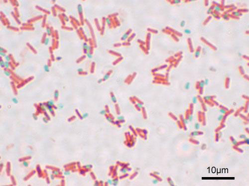 Endospore stain of Bacillus subtilis 
