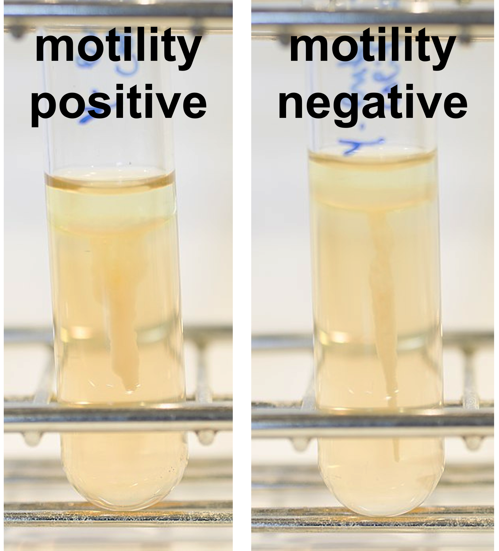 motility results in the SIM deep showing motility positive and motility negative results