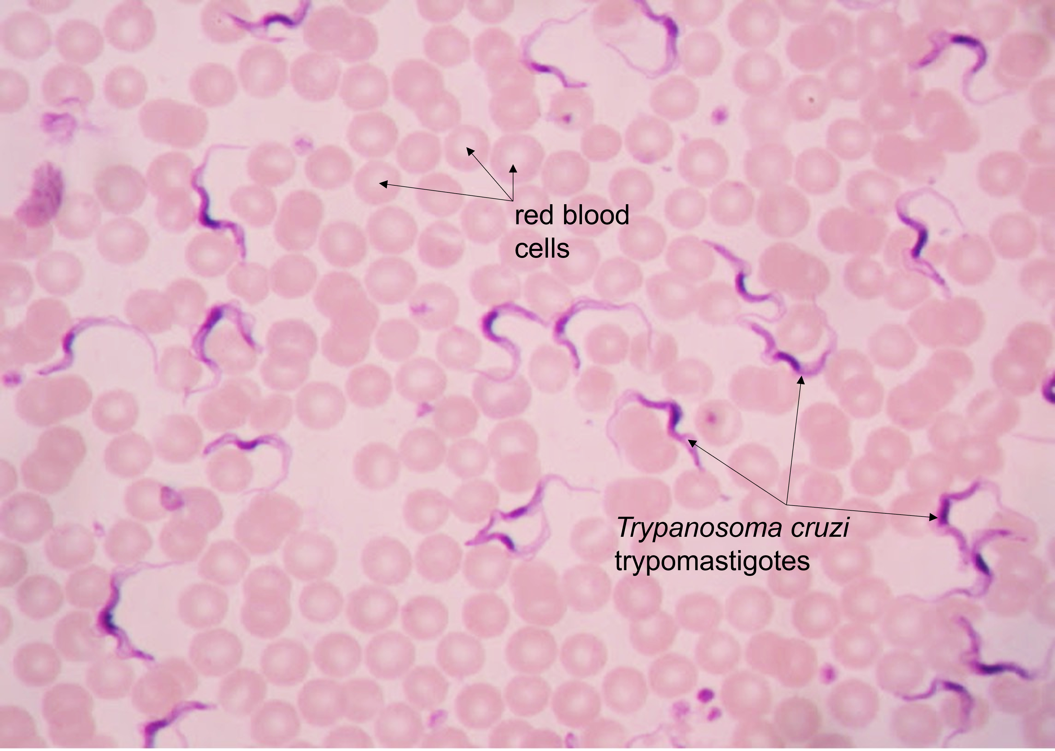 Trypanosoma in blood smear labeled
