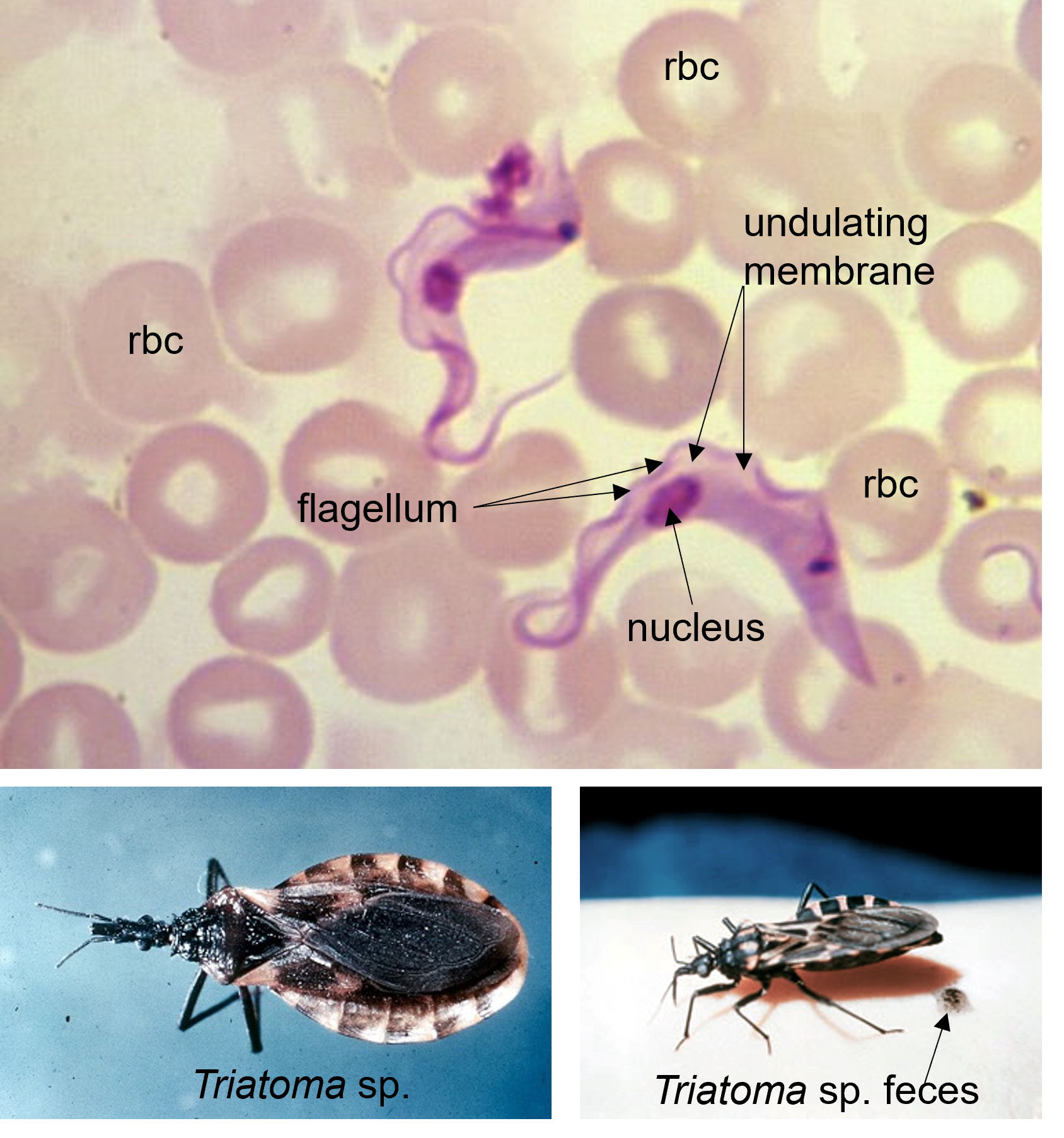Trypanosoma structure in microscopic image living between human red blood cells; Triatoma bugs that transmit Trypanosoma