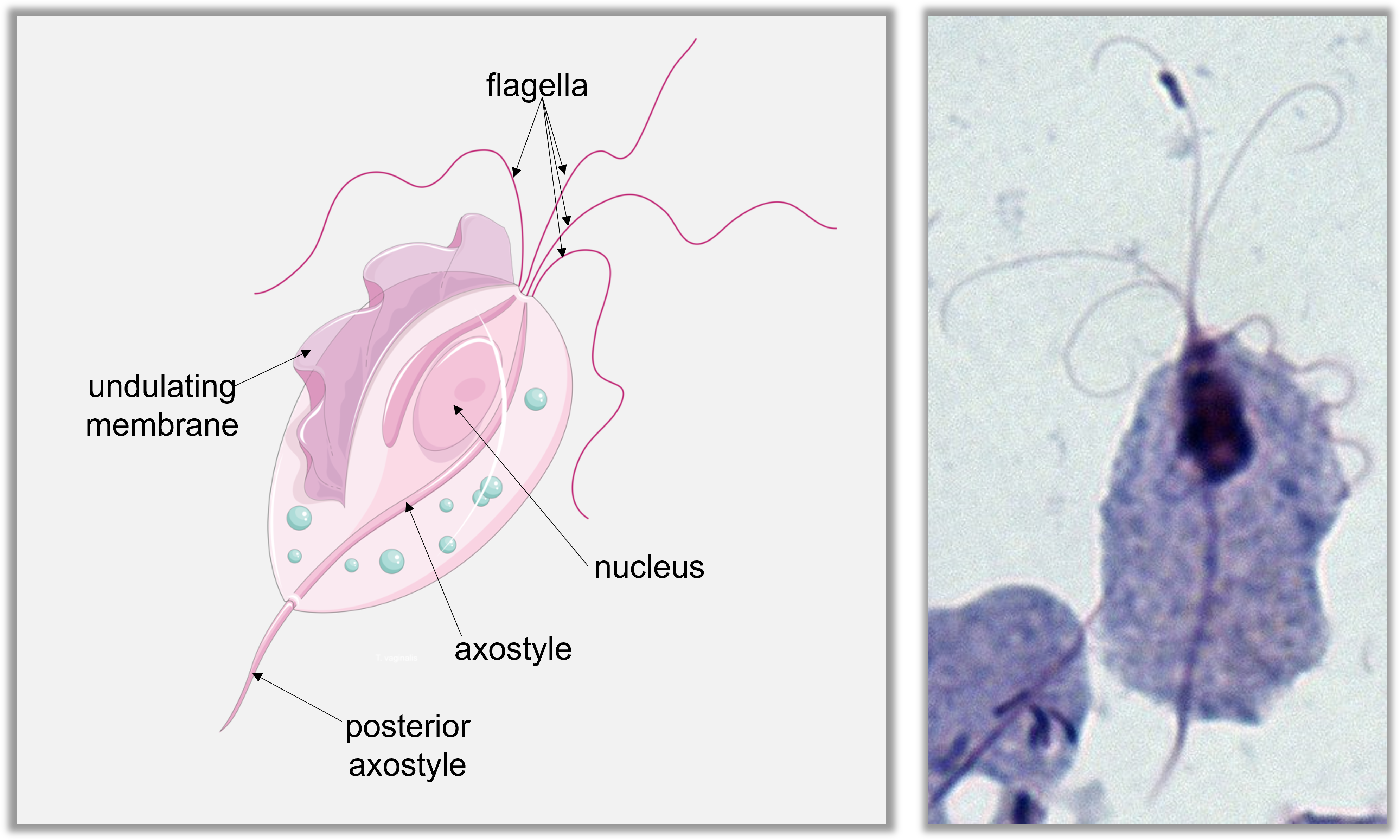 Trichomonas vaginalis cell structure shown along side a microscopic image of T. vaginalis