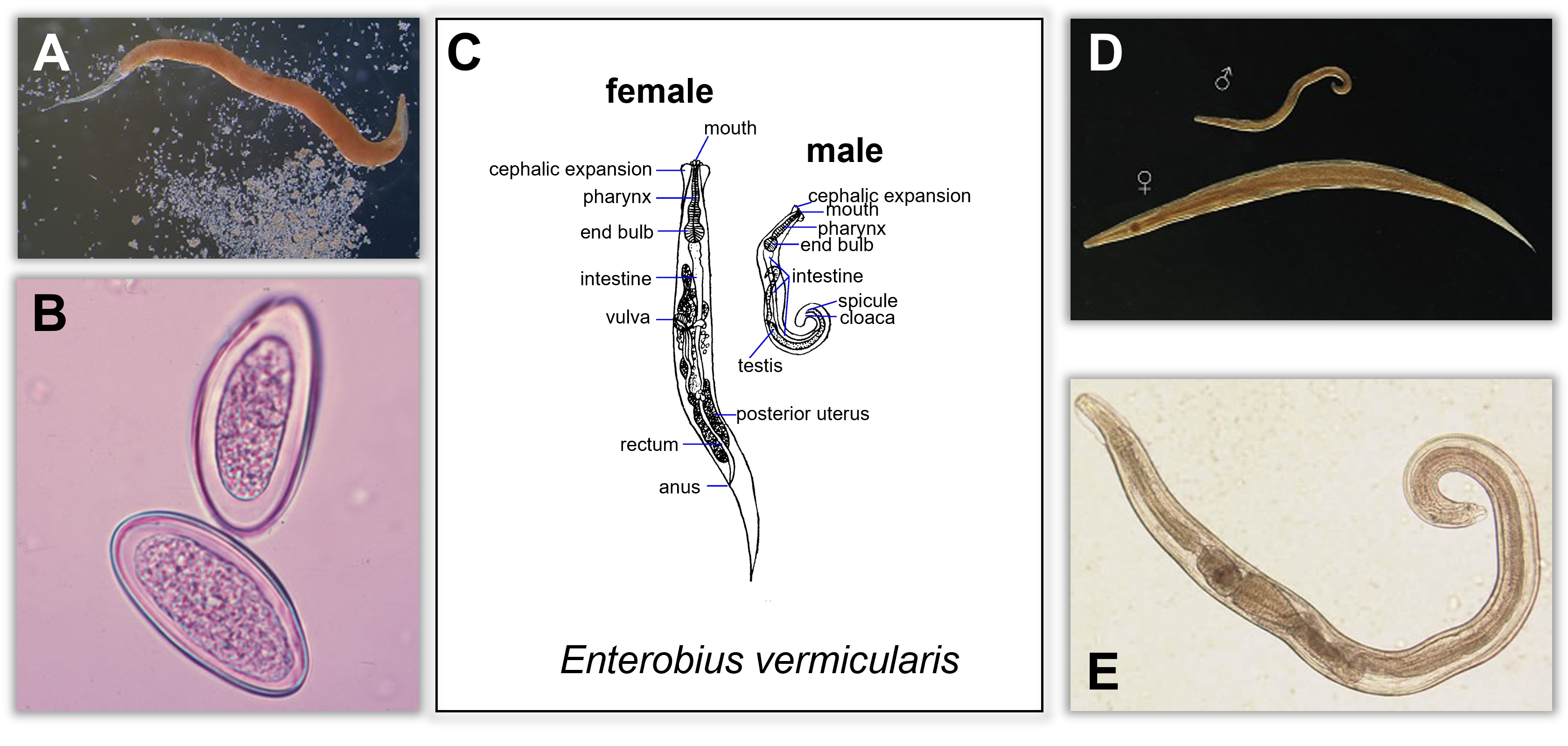 microscopic images of adult Enterobius vermicularis worms and their eggs; diagram of worm anatomy