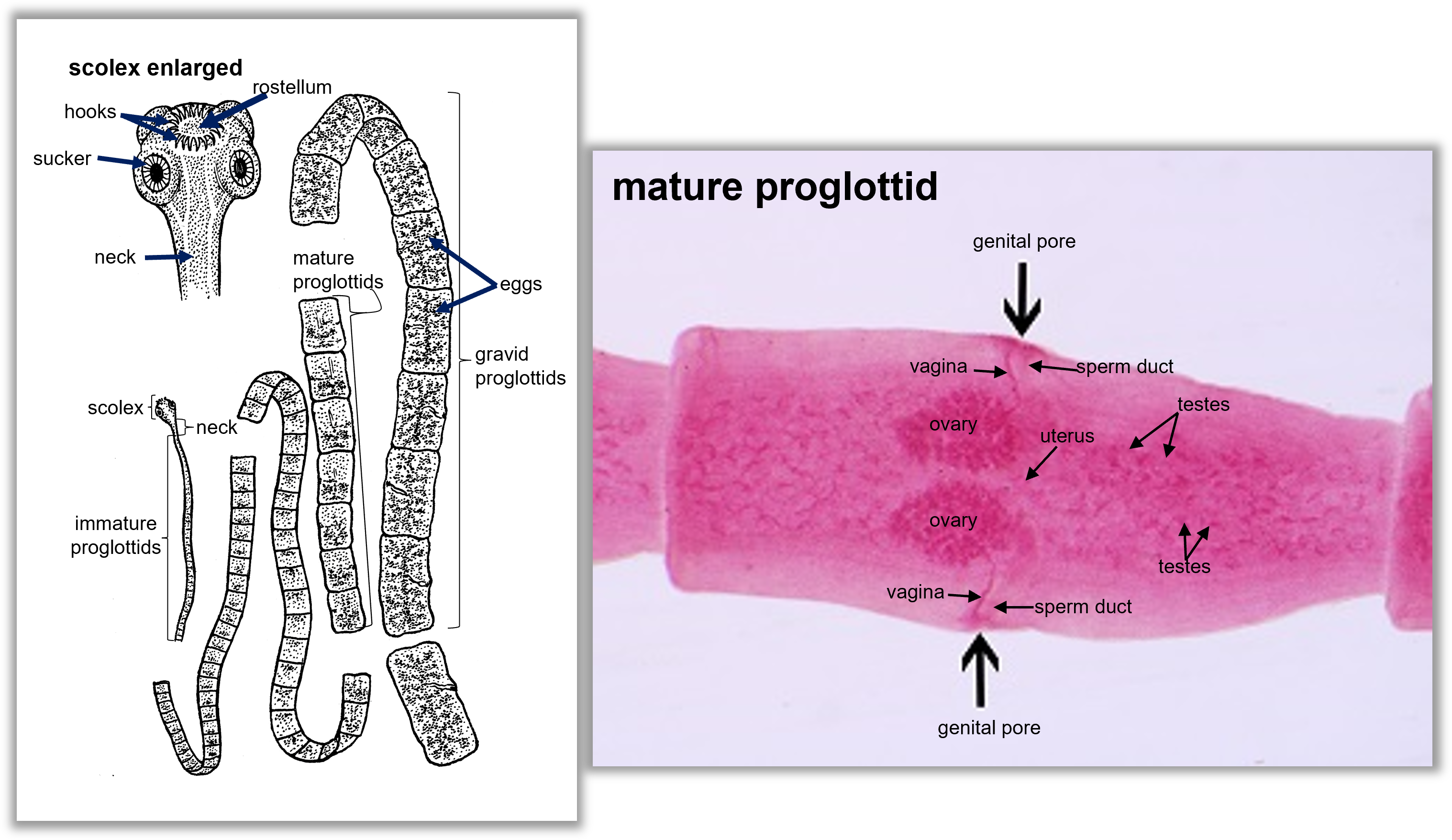 anatomy of tapeworm