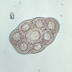 egg of Dipylidium caninum