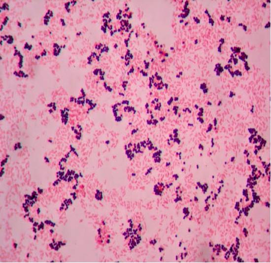 a single photo of Gram stain results