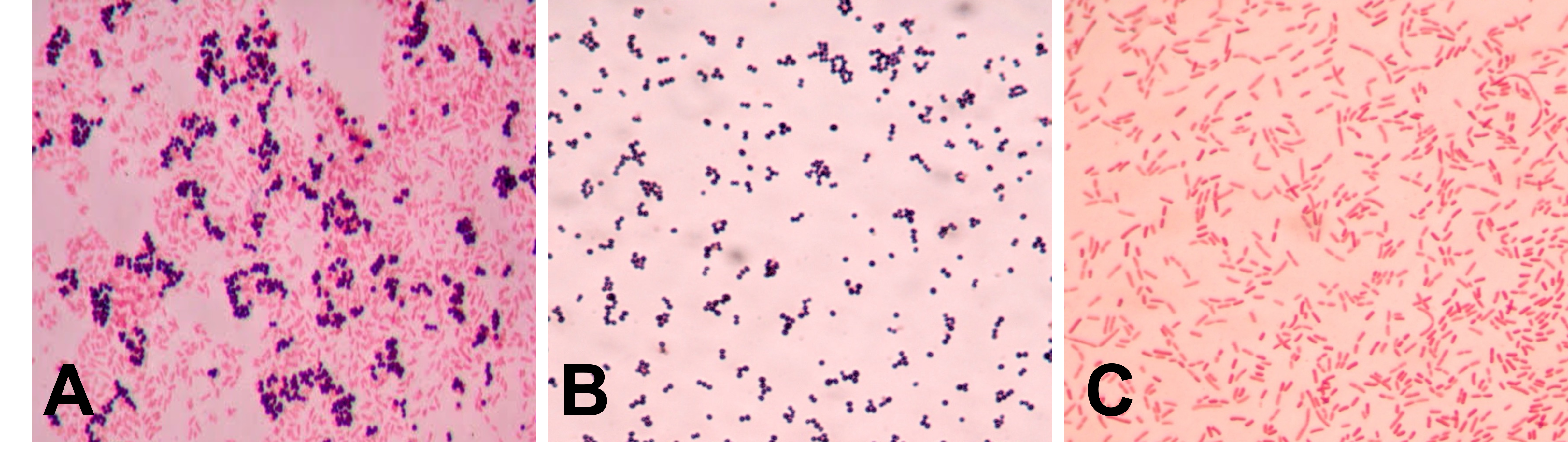 Gram stain composite figure showing three different images compiled into a single figure of three different Gram stains