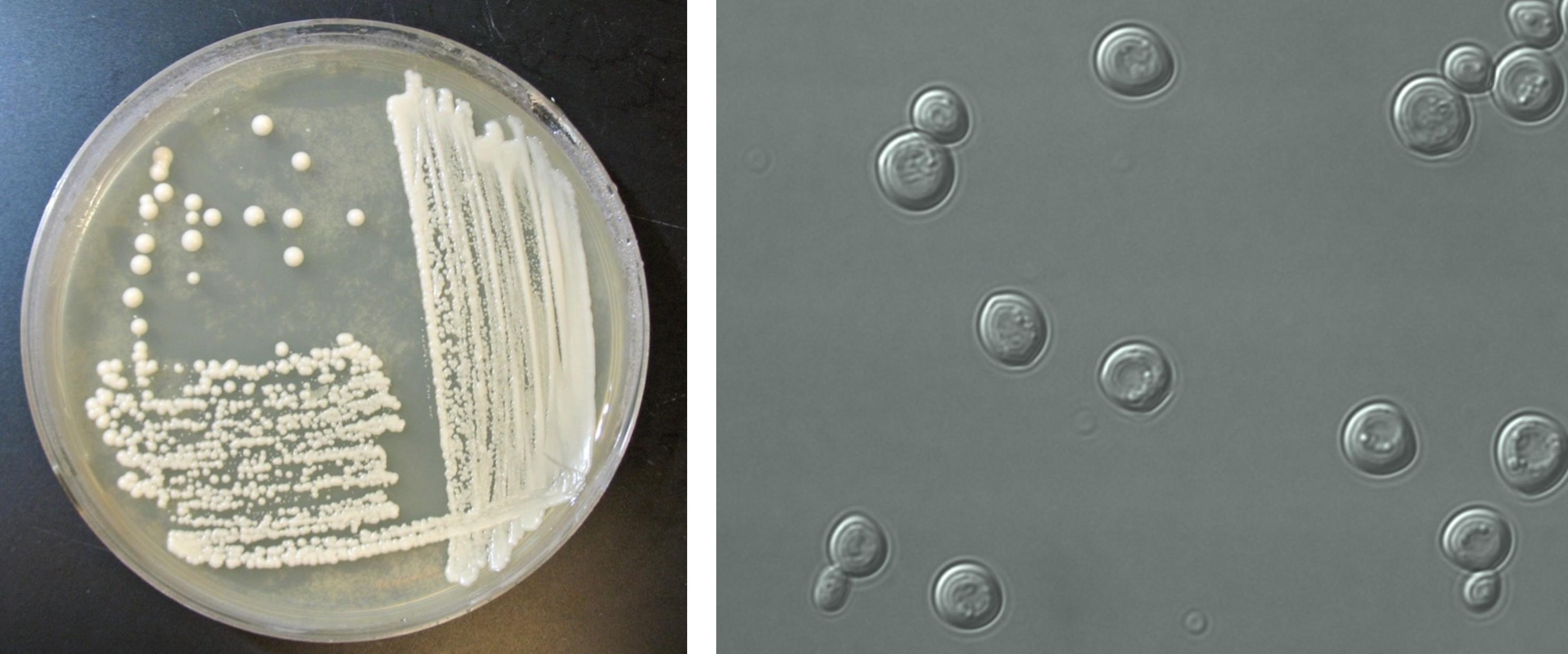 yeast growing on a petri plate; microscopic image of yeast cells