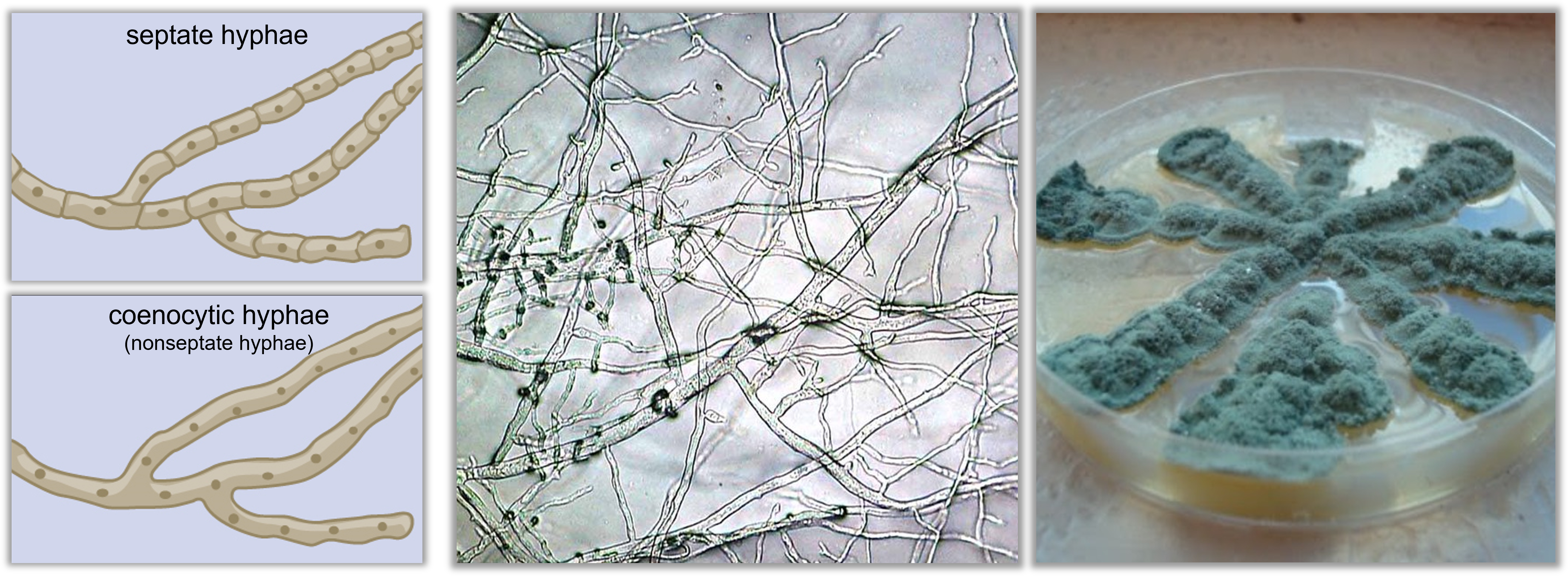 diagrams of different types of hyphae; microscopic image of hyphae; mold growing on a petri plate