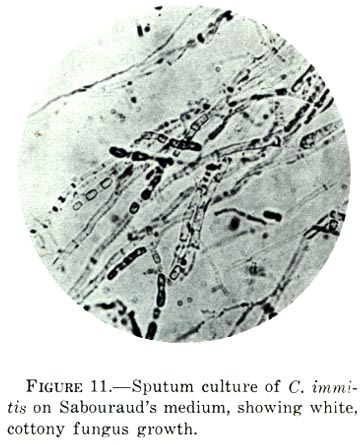 Coccidioides immitis on Sabouraud's medium