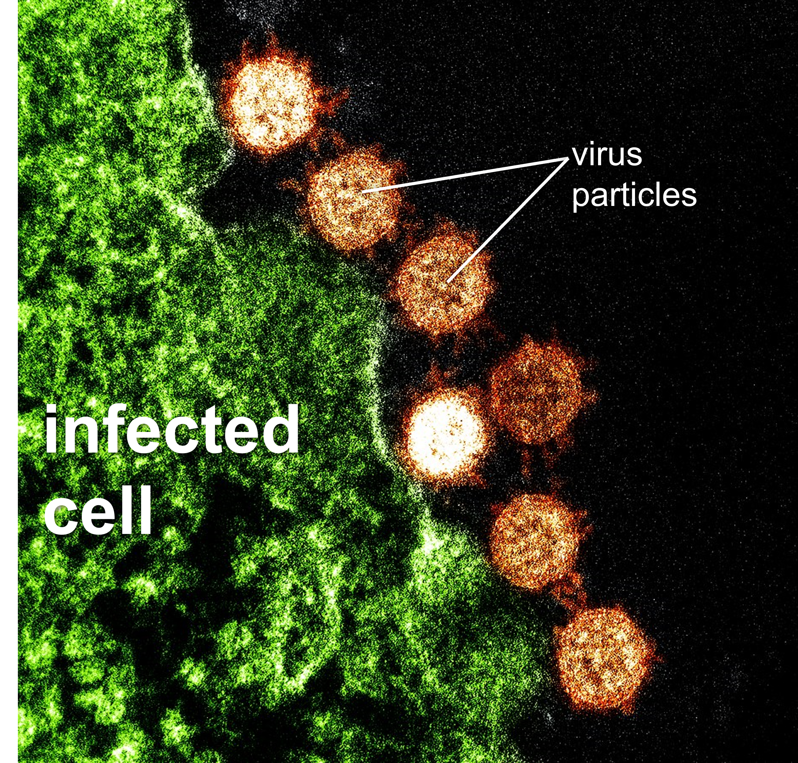 SARS virus particles and infected cell