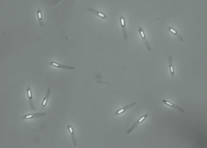 Lab-5-6-Endospores-300x215.png