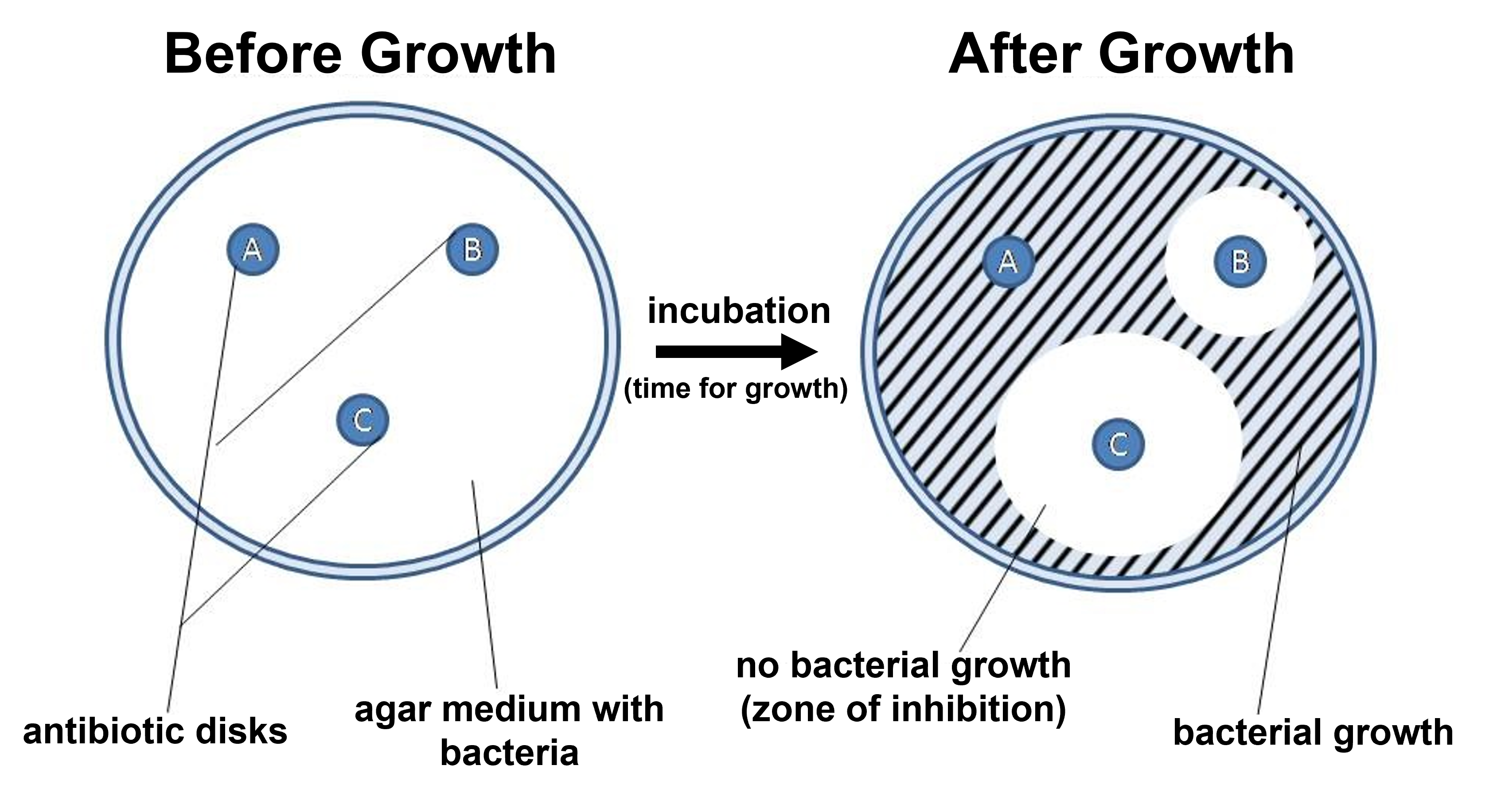 streaking a petri plate with bacteria and adding antibiotic discs produces circular regions where there is no growth surrounding the antibiotic discs called zones of inhibition